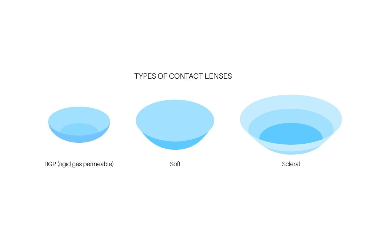 Diagram showing three types of contact lenses: rigid gas permeable, soft, and scleral.